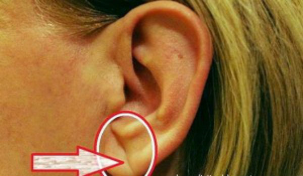 Zdjęcie 5 faktów o zdrowiu, które można wyczytać z wyglądu ucha! #2