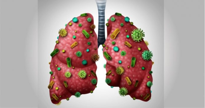 Zdjęcie 6 czynności, które oczyszczą twoje płuca z toksyn i pyłu #3