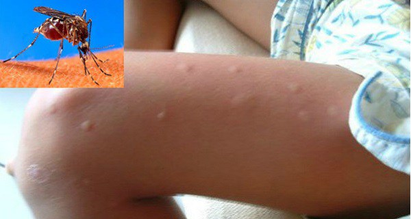 Zdjęcie Jak przygotować naturalny i skuteczny spray na komary? #1