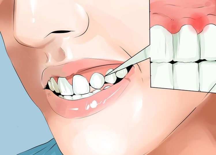 Boli Cię ząb? Sprawdź 3 możliwe przyczyny, o których byś nie pomyślała