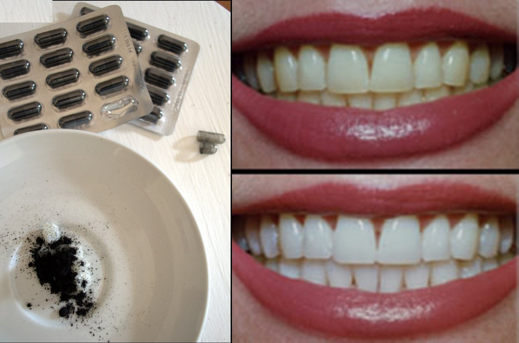 Bielsze zęby w 3 minuty! Tego sposobu jeszcze nie znałyście.