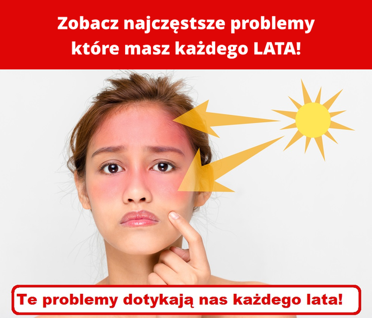 Zobacz najczęstsze problemy które masz każdego LATA!