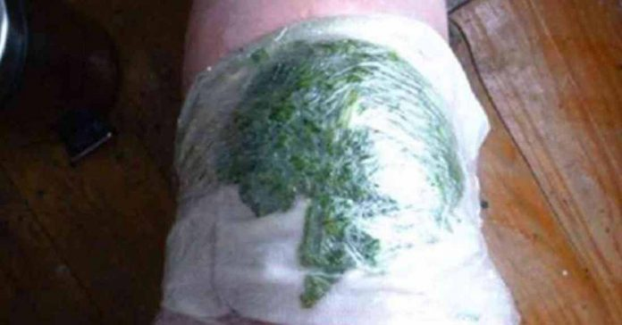 Zdjęcie Genialne zastosowania liści kapusty – ból stawów, wrastający paznokieć, gojenie ran #1