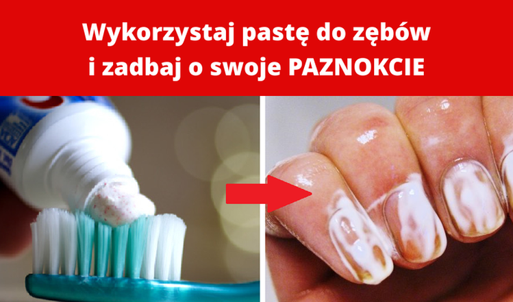 Wykorzystaj pastę do zębów i zadbaj o swoje PAZNOKCIE