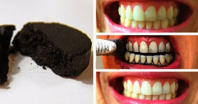 Zdjęcie Bielsze zęby w 3 minuty! Tego sposobu jeszcze nie znałyście. #1